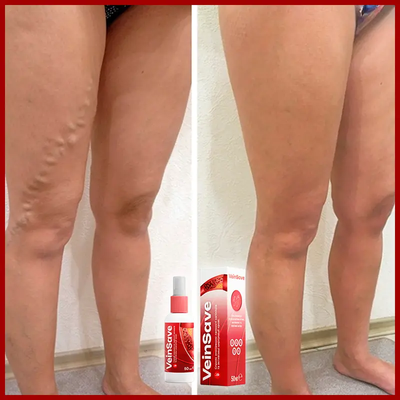 VeinSave відгук 1