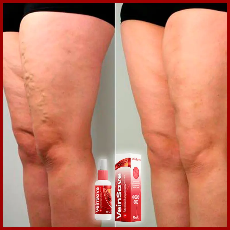 VeinSave відгук 3