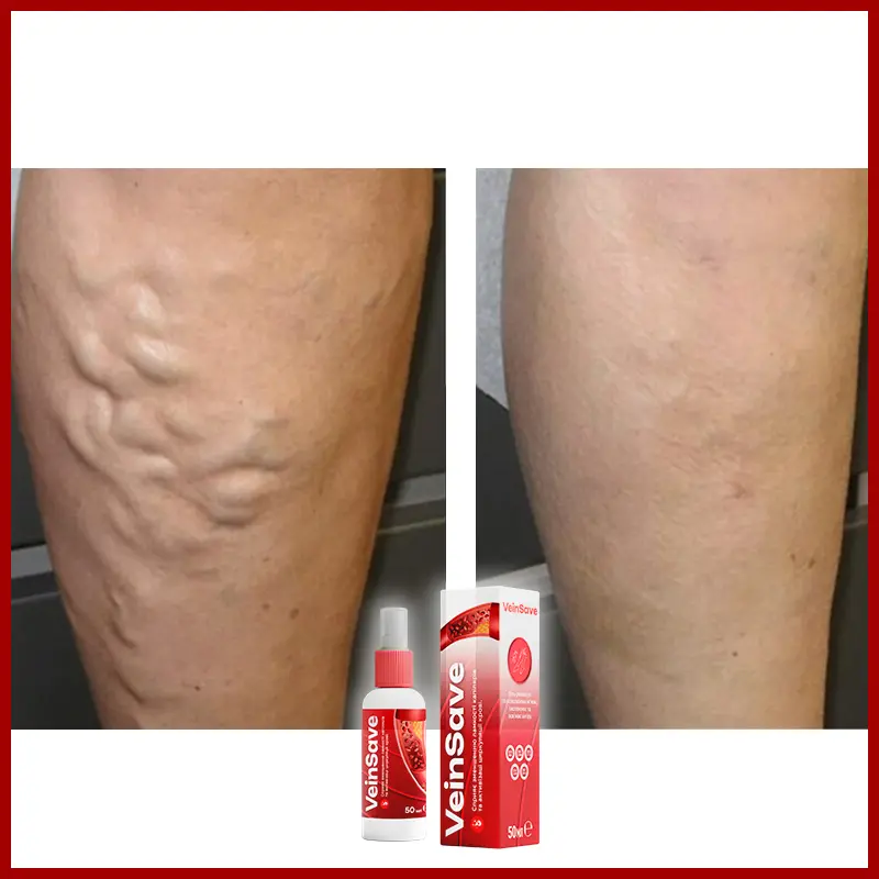 VeinSave відгук 4