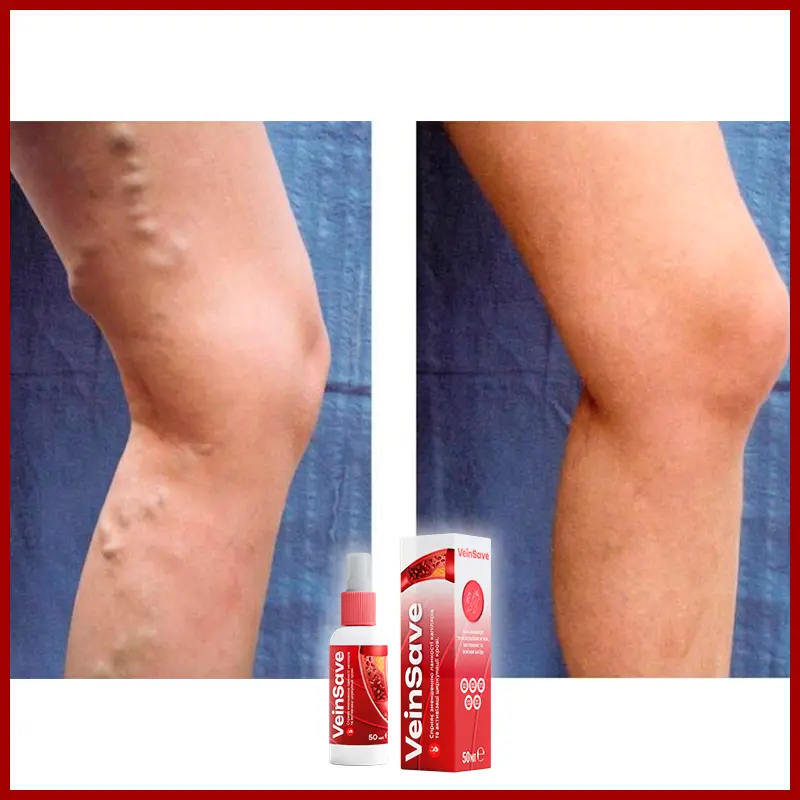 VeinSave відгук 5