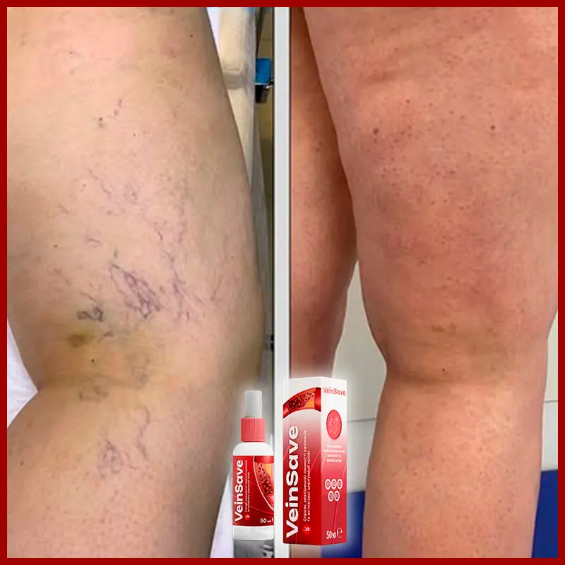 VeinSave відгук 7