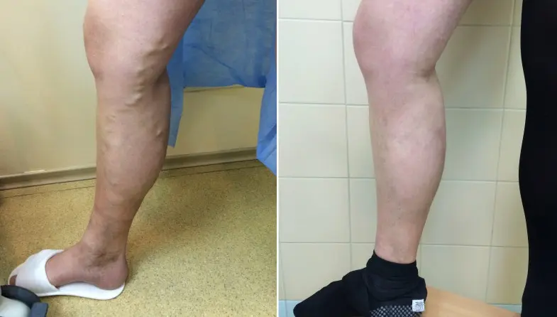 Фото відгук