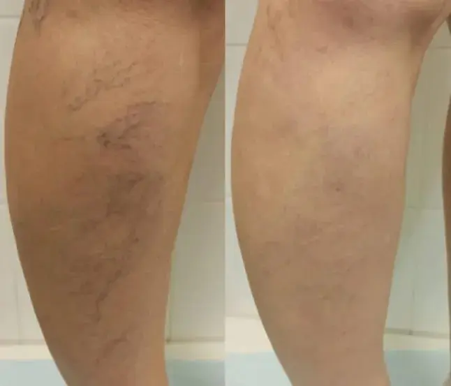 Фото відгук